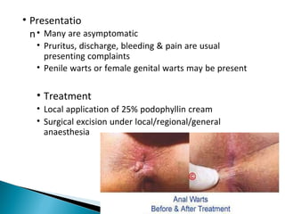 • Presentatio
n• Many are asymptomatic
• Pruritus, discharge, bleeding & pain are usual
presenting complaints
• Penile warts or female genital warts may be present
• Treatment
• Local application of 25% podophyllin cream
• Surgical excision under local/regional/general
anaesthesia
 