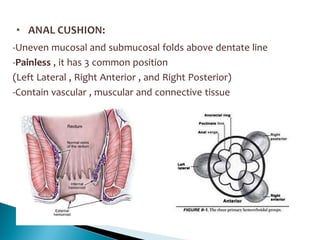 -Uneven mucosal and submucosal folds above dentate line
-Painless , it has 3 common position
(Left Lateral , Right Anterior , and Right Posterior)
-Contain vascular , muscular and connective tissue
 