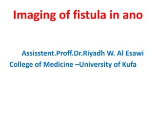 Imaging of fistula in ano
Assisstent.Proff.Dr.Riyadh W. Al Esawi
College of Medicine –University of Kufa
 