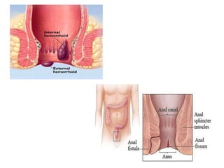 Anal Canal-WPS Office.pptx