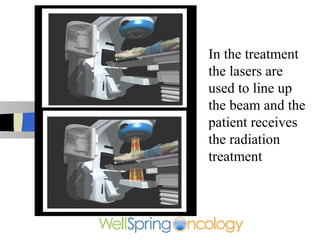In the treatment
the lasers are
used to line up
the beam and the
patient receives
the radiation
treatment
 