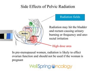 Side Effects of Pelvic Radiation

                                     Radiation fields


                            Radiation may hit the bladder
                            and rectum causing urinary
                            burning or frequency and ano-
                            rectal irritation

                               High dose area

In pre-menopausal women, radiation is likely to effect
ovarian function and should not be used if the woman is
pregnant
 