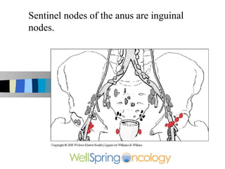 Sentinel nodes of the anus are inguinal
nodes.
 