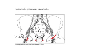 Sentinel nodes of the anus are inguinal nodes.
 