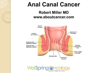 Anal Canal Cancer
Robert Miller MD
www.aboutcancer.com
 