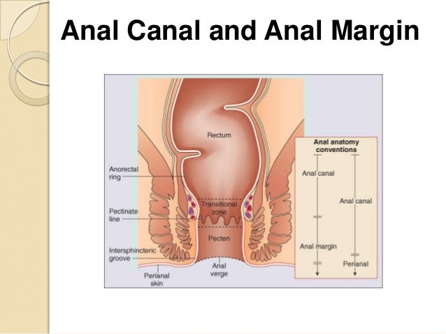 Lump Inside Anal Canal 7