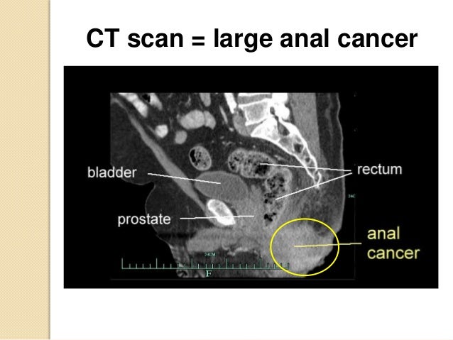 Anal Scan 47