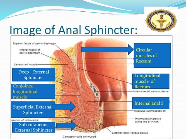 Anal fissure & fistula in ano PPT By Dr Anil Kumar, Assistant Professor ...