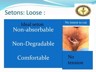 Anal fissure & fistula in ano PPT By Dr Anil Kumar, Assistant Professor ...