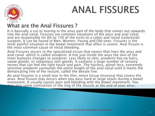 What are the Anal Fissures ?
It is basically a cut or tearing in the anus part of the body that comes out upwards
into the anal canal. Fissures are common situations of the anus and anal canal
and are responsible for 6% to 15% of the visits to a colon and rectal (colorectal)
surgeon. It can be found in Men, Women, Young and Old ones. Fissures is the
most painful situation in the bowel movement that often is severe. Anal fissure is
the most common cause of rectal bleeding.
Anal Fissures occurs in the specialized tissue that covers that lines the anus and
anal canal which is called anoderm. A line just inside the anus the skin of the
inner buttocks changes to anoderm. Less likely to skin, anoderm has no hairs,
sweat glands, or sebaceous (oil) glands. It contains a large number of sensory
nerves that can feel the light touch and pain. The hairless, gland-less, extremely
sensitive anoderm surrounds the entire length of the anal canal until it meets the
demarcating line of the rectum, called the denate line.
An anal fissures is a small tear in the thin, moist tissue (mucosa) that covers the
anus. Anal fissure may occurs when you pass hard or large stools during a bowel
movement. It usually causes pain and bleeding with the bowel movement. You
may also some contraction in the ring of the muscle at the end of your anus.
1
http://www.jyotinursinghome.com/fissure-treatment-in-jaipur.html
 