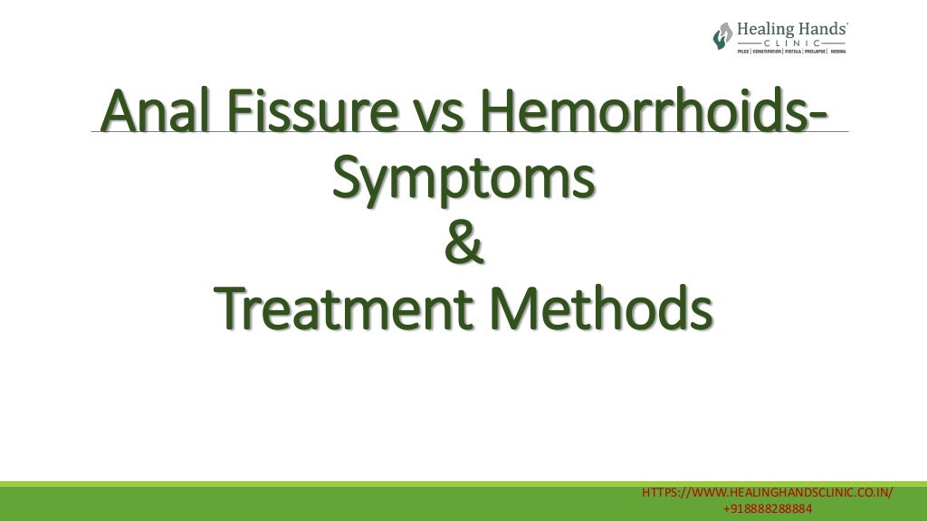 Anal Fissure vs Hemorrhoids Symptoms and Treatment Methods
