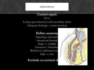 Anal fistula.. by. dr.saleh bakar.. taishan medical university | PPT