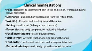 anal fistula .pptx (1).pptx. what is anal fistula underlying the