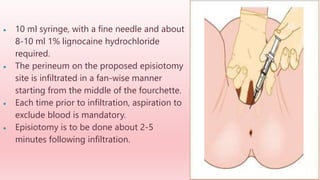  10 ml syringe, with a fine needle and about
8-10 ml 1% lignocaine hydrochloride
required.
 The perineum on the proposed episiotomy
site is infiltrated in a fan-wise manner
starting from the middle of the fourchette.
 Each time prior to infiltration, aspiration to
exclude blood is mandatory.
 Episiotomy is to be done about 2-5
minutes following infiltration.
 