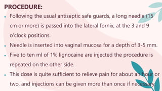 PROCEDURE:
● Following the usual antiseptic safe guards, a long needle (15
cm or more) is passed into the lateral fornix, at the 3 and 9
o'clock positions.
● Needle is inserted into vaginal mucosa for a depth of 3-5 mm.
● Five to ten ml of 1% lignocaine are injected the procedure is
repeated on the other side.
● This dose is quite sufficient to relieve pain for about an hour or
two, and injections can be given more than once if necessary.
 
