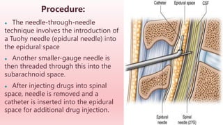 Procedure:
● The needle-through-needle
technique involves the introduction of
a Tuohy needle (epidural needle) into
the epidural space
● Another smaller-gauge needle is
then threaded through this into the
subarachnoid space.
● After injecting drugs into spinal
space, needle is removed and a
catheter is inserted into the epidural
space for additional drug injection.
 