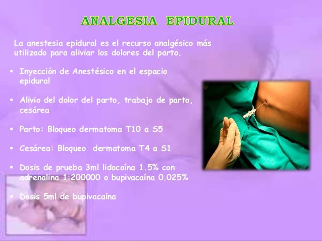 Analgesia en la labor de parto