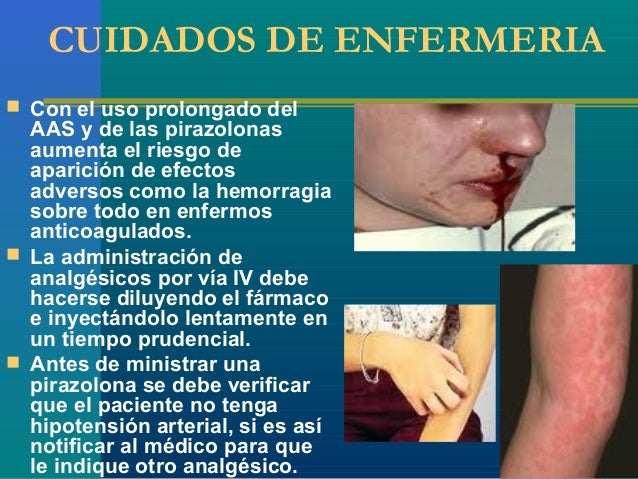 paracetamol dipirona e Analgesicos