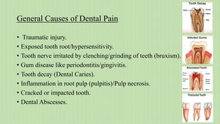 Analgesics in Dentistry | PPTX