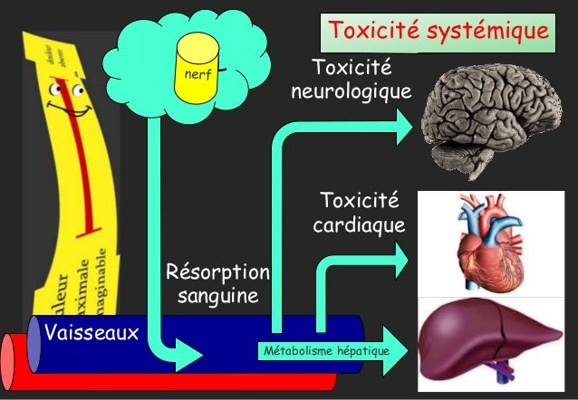 Analgésie locorégionale continue périnerveuse et péridurale Analgésie locorégionale continue périnerveuse et péridurale