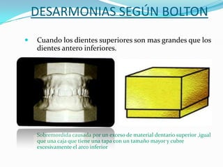 DESARMONIAS SEGÚN BOLTON


Cuando los dientes superiores son mas grandes que los
dientes antero inferiores.

Sobremordida causada por un exceso de material dentario superior ,igual
que una caja que tiene una tapa con un tamaño mayor y cubre
excesivamente el arco inferior

 