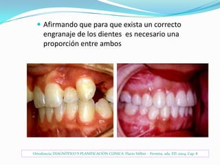  Afirmando que para que exista un correcto

engranaje de los dientes es necesario una
proporción entre ambos

Ortodoncia; DIAGNÓTICO Y PLANIFICACIÓN CLÍNICA: Flavio Vellini - Ferreira, 2da. ED. 2004, Cap. 8

 