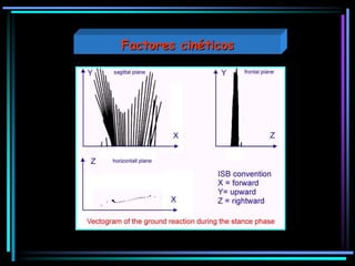 Factores cinéticos
 
