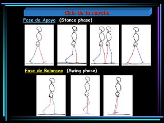 Fase de Apoyo (Stance phase)
Fase de Balanceo (Swing phase)
Ciclo de la marcha
 