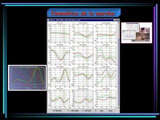 Cinemática de la marcha
 