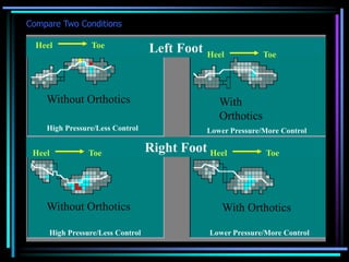 Compare Two Conditions
Without Orthotics With
Orthotics
Without Orthotics With Orthotics
Left Foot
Right Foot
High Pressure/Less Control
High Pressure/Less Control
Lower Pressure/More Control
Lower Pressure/More Control
Heel Toe
Heel Toe
Heel Toe
Heel Toe
 