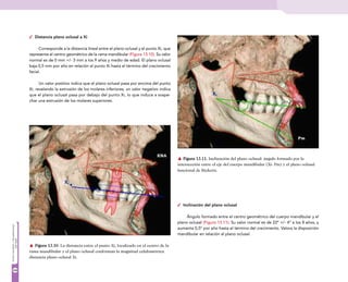 Analisis de-ricketts | PDF