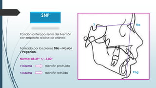 Posición anteroposterior del Mentón
con respecto a base de cráneo
Formado por los planos Silla – Nasion
y Pogonion.
Norma:...