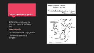 Grosor del Labio superior
Distancia entre borde las
interno y externo del labio
sup.
Interpretación:
Aumentado:Labio sup grueso
Disminuido: Labio sup
delgado
 