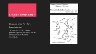 Grosor del mentón blando
Distancia entre Pg y Pg’.
Interpretación:
Aumentado: Se puede
perder soporte del labio inf. Al
retroinclinar 1i perfil
cóncavo.
 