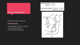 Grosor de la Papada
Distancia entre Mey Me’.
Interpretación:
Aumentado: Tener cuidado
con la retroposición
mandibular quirúrgica.
 