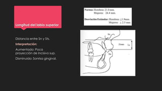 Longitud del labio superior
Distancia entre Sn y Sts.
Interpretación:
Aumentado: Poca
proyección de Incisivo sup.
Disminuido: Sonrisa gingival.
 