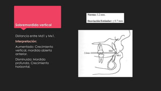 Sobremordida vertical
Distancia entre Md1 y Mx1.
Interpretación:
Aumentado: Crecimiento
vertical, mordida abierta
anterior.
Disminuida: Mordida
profunda, Crecimiento
horizontal.
 