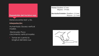 Exposición del Incisivo sup.
Distancia entre Md1 y Sts.
Interpretación:
Aumentado: Exceso vertical
maxilar.
Disminuida: Poco
crecimiento vertical maxilar.
• Tomar en cuenta la
longitud del labio sup
 