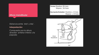 Altura mandibular
Distancia entre Md1 y Me’.
Interpretación:
Compuesta por la altura
alveolar anterior inferior y la
papada
 