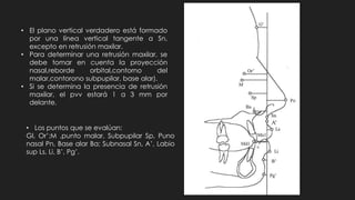 • El plano vertical verdadero está formado
por una línea vertical tangente a Sn,
excepto en retrusión maxilar.
• Para determinar una retrusión maxilar, se
debe tomar en cuenta la proyección
nasal,reborde orbital,contorno del
malar,contorono subpupilar, base alar).
• Si se determina la presencia de retrusión
maxilar, el pvv estará 1 a 3 mm por
delante.
• Los puntos que se evalúan:
Gl, Or’;M ,punto malar, Subpupilar Sp, Puno
nasal Pn, Base alar Ba; Subnasal Sn, A’, Labio
sup Ls, Li, B’, Pg’.
 