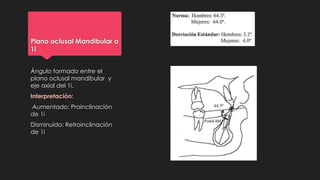 Plano oclusal Mandibular a
1i
Ángulo formado entre el
plano oclusal mandibular y
eje axial del 1i.
Interpretación:
Aumentado: Proinclinación
de 1i
Disminuido: Retroinclinación
de 1i
 