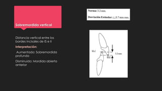 Sobremordida vertical
Distancia vertical entre los
bordes incisales de IS e Ii
Interpretación:
Aumentado: Sobremordida
profunda
Disminuido: Mordida abierta
anterior
 