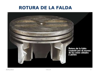 ROTURA DE LA FALDA
30/01/2015 7F.H.C.H.
 