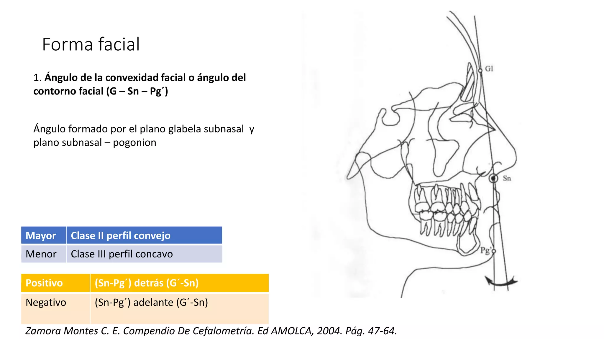 Análisis de dr Legan y burstone.pptx