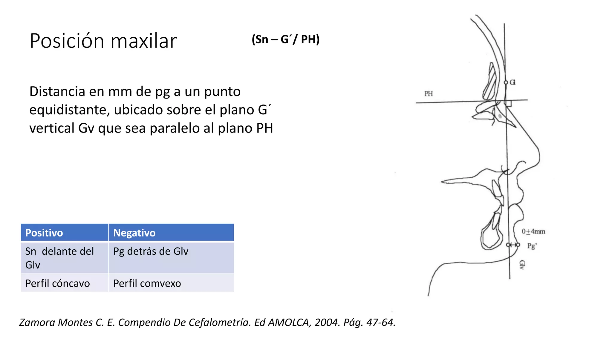 Análisis de dr Legan y burstone.pptx