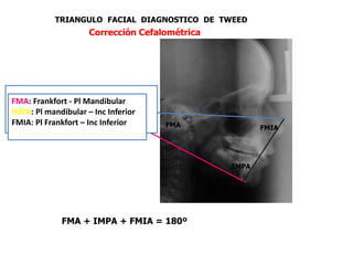 ANALISIS DE ESPACIO DE TWEED.ppt