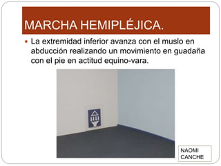 MARCHA HEMIPLÉJICA.
 La extremidad inferior avanza con el muslo en
abducción realizando un movimiento en guadaña
con el pie en actitud equino-vara.
NAOMI
CANCHE
 
