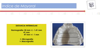 Indice de Mayoral
DISTANCIA INTERMOLAR
Normognatia: 35 mm +/- 1.41 mm
41 mm
47 mm +/- 1 mm
<: Micrognatia
>: Macrognatia
 