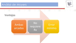 Análisis de Moyers
Ventajas
 