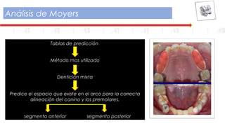 Tablas de predicción
Método mas utilizado
Dentición mixta
Predice el espacio que existe en el arco para la correcta
alineación del canino y los premolares.
segmento anterior segmento posterior
Análisis de Moyers
 